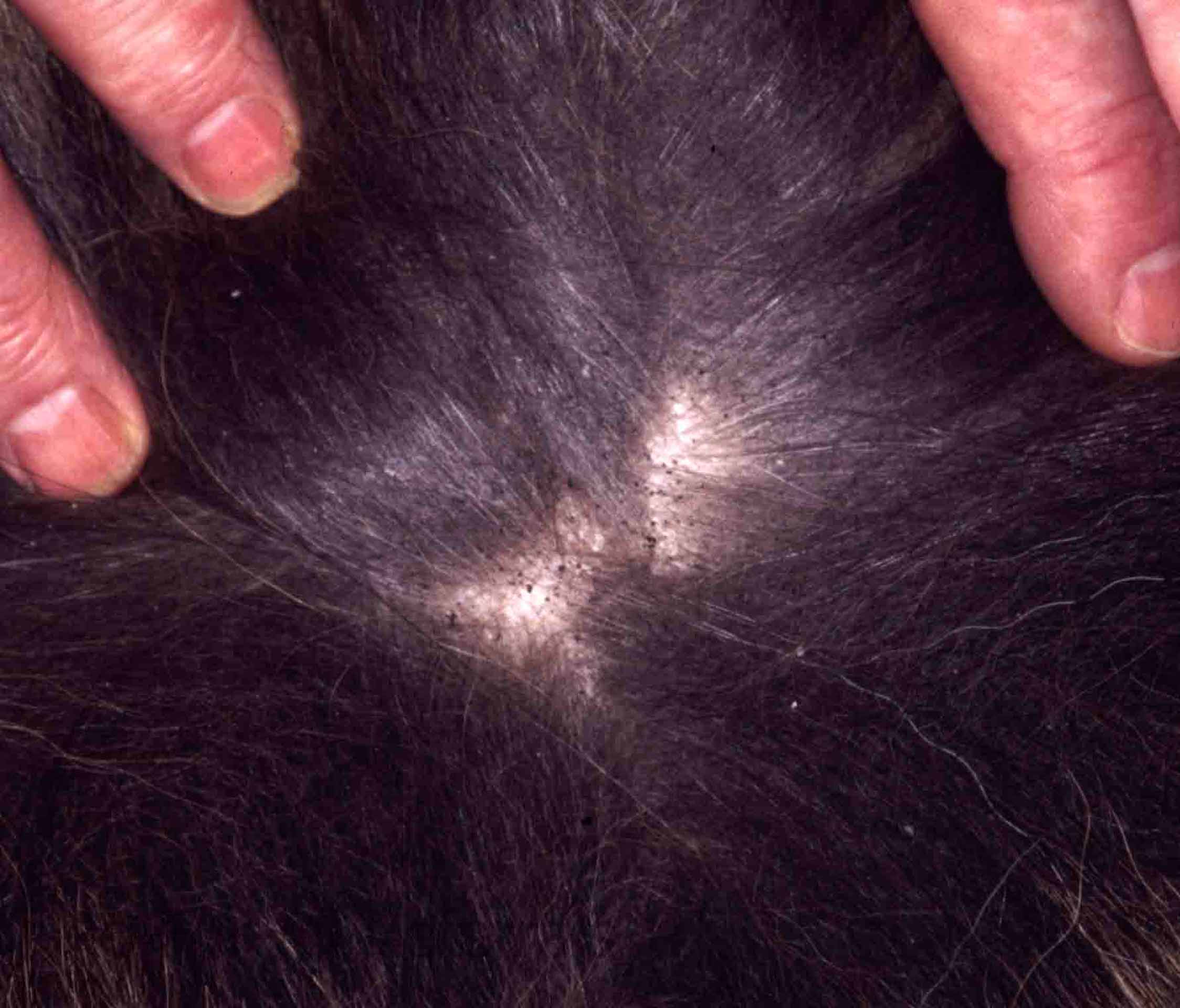 Flea faeces
